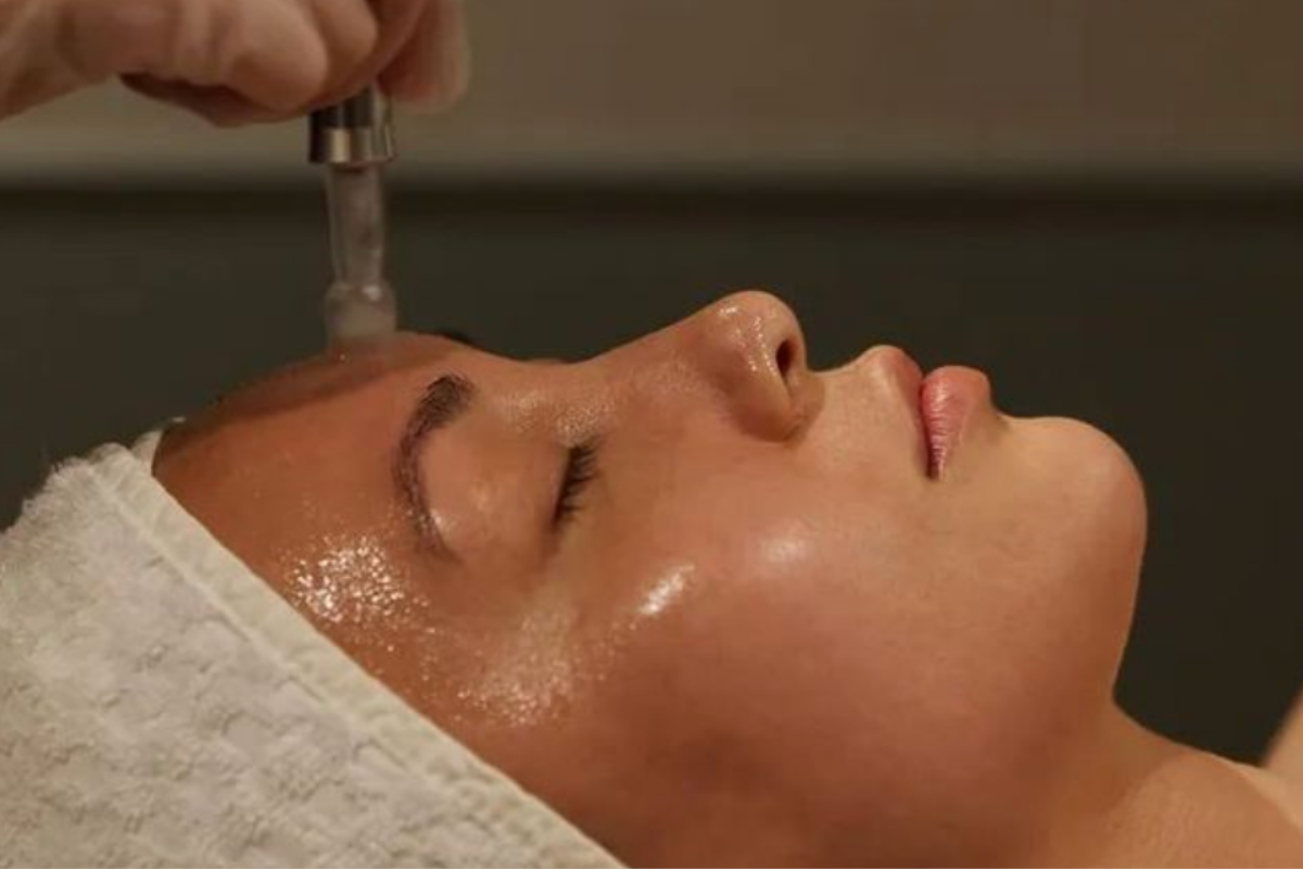 Microneedling forløb – BB Glow